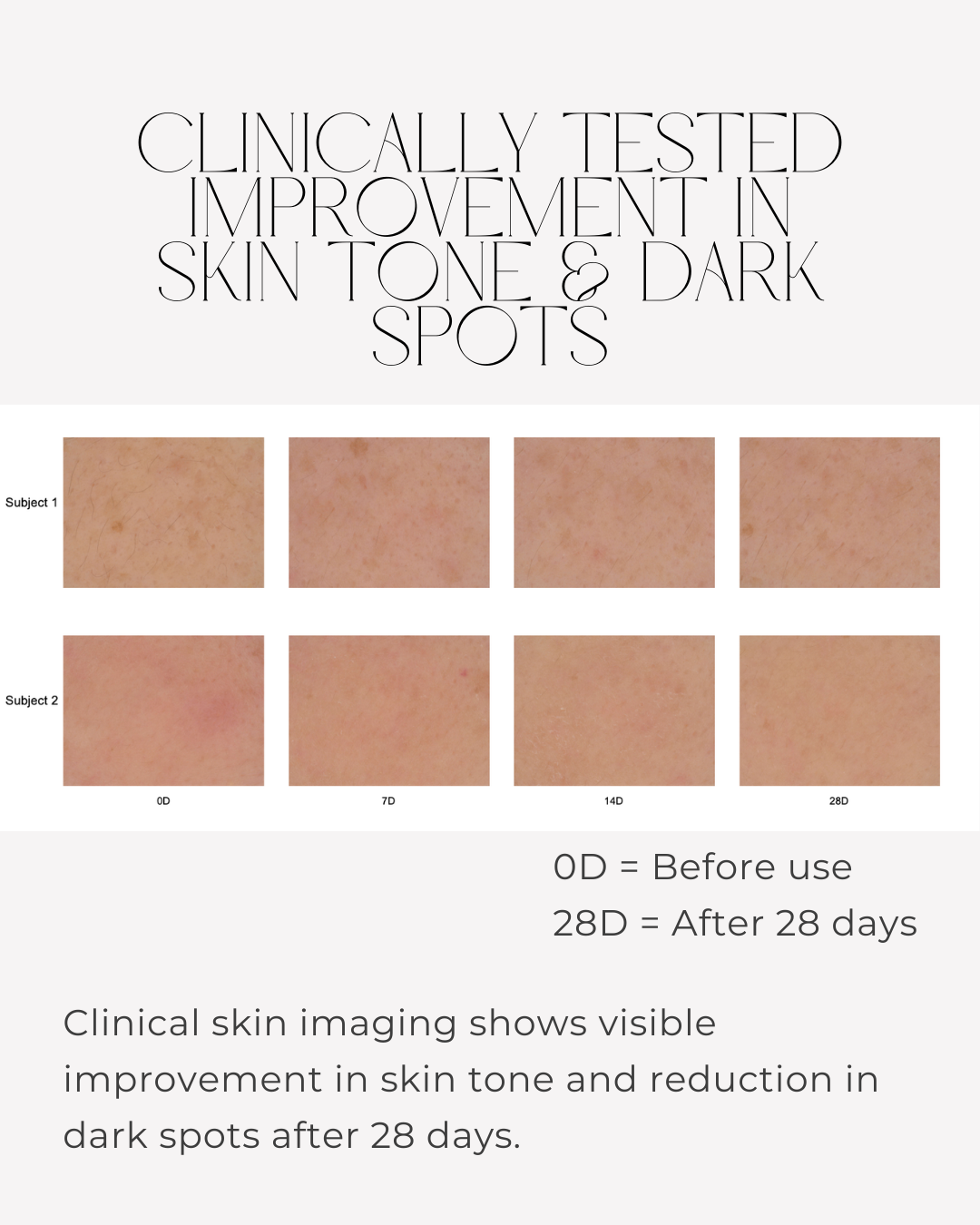 Clinical skin imaging showing improved skin tone and reduced visible dark spots after 28 days using 28N B⁶