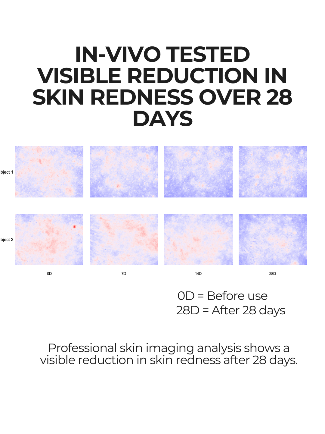 Professional skin imaging showing visible reduction in skin redness after 28 days using 28N B⁶ Brightening Formula
